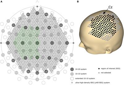 Individual finger movement decoding using a novel ultra-high-density electroencephalography-based brain-computer interface system